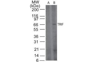 TRIF Western Blot. (TICAM1 antibody)