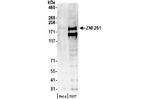 Western Blotting (WB) image for anti-Zinc Finger Protein 261 (ZMYM3) (AA 250-300) antibody (ABIN7449408) (ZMYM3 antibody  (AA 250-300))
