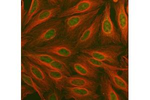 IF analysis of PDK2 using anti-PDK2 antibody (ABIN5693279) and anti-Tubulin Alpha antibody (ABIN7600339). (PDK2 antibody  (AA 81-177))