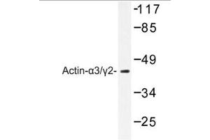 Image no. 1 for anti-Actin, gamma 2, Smooth Muscle, Enteric (ACTG2) antibody (ABIN265300) (ACTG2 antibody)