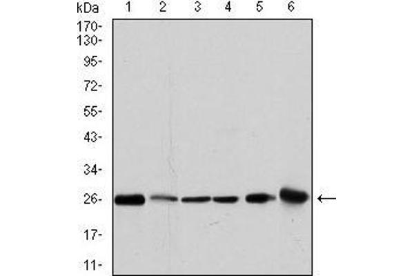 GSTM1 antibody