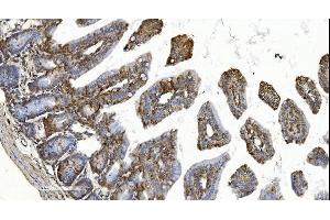 IHC analysis of YTHDF2 using anti-YTHDF2 antibody (ABIN7603191). (YTHDF2 antibody  (N-Term))