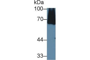 Detection of C8a in Mouse Serum using Polyclonal Antibody to Complement Component 8a (C8a) (C8A antibody  (AA 21-300))