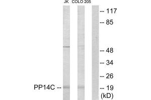 Western Blotting (WB) image for anti-Protein Phosphatase 1, Regulatory (Inhibitor) Subunit 14C (PPP1R14C) (Internal Region) antibody (ABIN1849804)