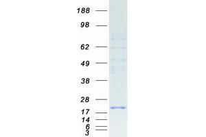 Validation with Western Blot (SEC11C Protein (Myc-DYKDDDDK Tag))