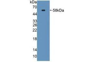 Western blot analysis of recombinant Mouse SPTLC3.
