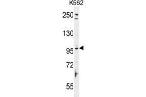 Western Blotting (WB) image for anti-Taste Receptor, Type 1, Member 2 (TAS1R2) antibody (ABIN2996356) (TAS1R2 antibody)