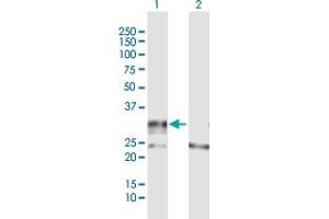 Western Blot analysis of ADAMTS4 expression in transfected 293T cell line by ADAMTS4 MaxPab polyclonal antibody. (ADAMTS4 antibody  (AA 1-339))