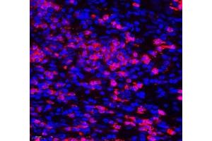 Immunofluorescence of paraffin embedded human colon cancer using Aldh4a1 (ABIN7073000) at dilution of 1: 400 (400x lens) (ALDH4A1 antibody)