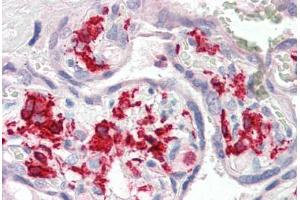 Human Placenta (formalin-fixed, paraffin-embedded) stained with AIF1 antibody ABIN337129 at 2. (Iba1 antibody  (AA 42-56))