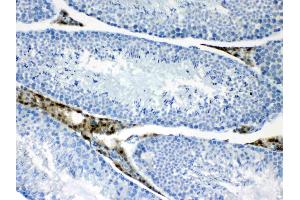 IHC analysis of CPI17 alpha using anti- CPI17 alpha antibody . (CPI-17 antibody  (AA 30-126))