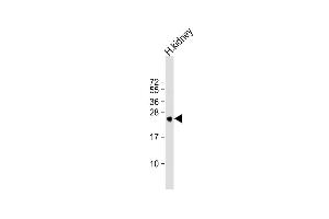 Anti-MSRA Antibody (N-term) at 1:1000 dilution + human kidney lysate Lysates/proteins at 20 μg per lane.