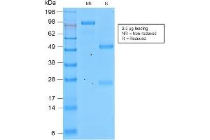 SDS-PAGE Analysis of Purified Involucrin Rabbit Recombinant Monoclonal Antibody (IVRN/2113R). (Recombinant Involucrin antibody)
