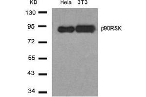 Image no. 1 for anti-Ribosomal Protein S6 Kinase, 90kDa, Polypeptide 1 (RPS6KA1) (Thr348) antibody (ABIN197329) (RPS6KA1 antibody  (Thr348))