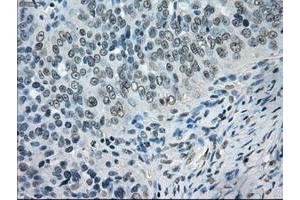 Image no. 6 for anti-Crystallin, alpha B (CRYAB) antibody (ABIN1497645) (CRYAB antibody)