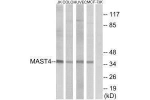 Western blot analysis of extracts from Jurkat cells, COLO cells, HUVEC cells and MCF-7 cells, using MAST4 antibody.