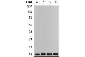 Western blot analysis of PTPS expression in Hela (A), mouse liver (B), mouse heart (C), rat kindey (D) whole cell lysates.