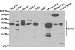 Western blot analysis of extracts of various cell lines, using EFNA1 antibody. (Ephrin A1 antibody)