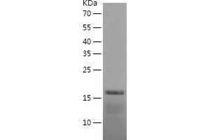 Western Blotting (WB) image for BTG Family, Member 2 (BTG2) (AA 1-158) protein (His tag) (ABIN7282844) (BTG2 Protein (AA 1-158) (His tag))