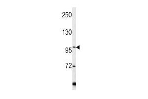 Western blot analysis of COL6A1 antibody in Y79 cell line lysates (35ug/lane)