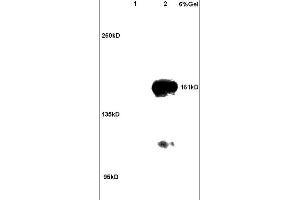 Lane 1: rat brain lysates Lane 2: human colon carcinoma lysates probed with Anti ROCK2 Polyclonal Antibody, Unconjugated (ABIN673359) at 1:200 in 4C.