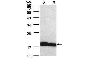 WB Image Sample(30 μg of whole cell lysate) A:H1299 B:HeLa S3, 12% SDS PAGE antibody diluted at 1:5000 (PPIA antibody  (C-Term))