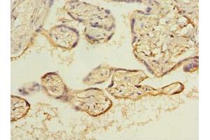 Immunohistochemistry of paraffin-embedded human placenta tissue using ABIN7143522 at dilution of 1:100