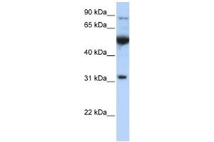 EIF2B1 antibody used at 1 ug/ml to detect target protein. (EIF2B1 antibody  (C-Term))