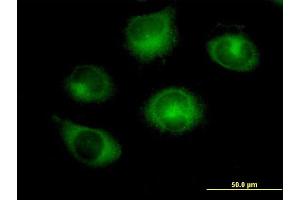 Immunofluorescence of purified MaxPab antibody to RABGAP1 on HeLa cell. (RABGAP1 antibody  (AA 1-997))