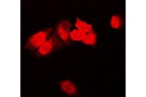 Immunofluorescent analysis of Focal Adhesion Kinase staining in HeLa cells. (FAK antibody  (Center))