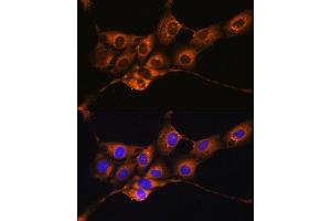 Immunofluorescence analysis of NIH/3T3 cells using SERPING1 antibody ( ABIN3022429, ABIN3022430, ABIN3022431 and ABIN6218816) at dilution of 1:100. (SERPING1 antibody  (AA 201-500))