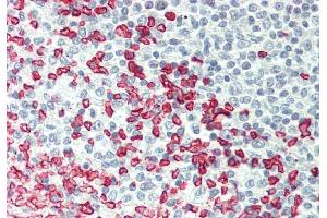 Rabbit Anti-ERMAP antibody  Formalin Fixed Paraffin Embedded Tissue: Human Spleen Primary antibody Concentration: 1:100 Secondary Antibody: Donkey anti-Rabbit-Cy3 Secondary Antibody Concentration: 1:200 Magnification: 20x Exposure Time: 0. (ERMAP antibody  (Middle Region))