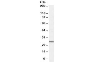 Western blot testing of mouse heart lysate with GPX3 antibody at 1ug/ml. (GPX3 antibody)