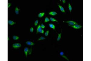 Immunofluorescent analysis of Hela cells using ABIN7146564 at dilution of 1:100 and Alexa Fluor 488-congugated AffiniPure Goat Anti-Rabbit IgG(H+L) (Calreticulin antibody  (AA 18-415))