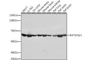 Western blot analysis of extracts of various cell lines, using K/Elp3 Rabbit mAb (ABIN1680361, ABIN3015008, ABIN3015009 and ABIN7101302) at 1:1000 dilution. (ELP3/KAT9 antibody)