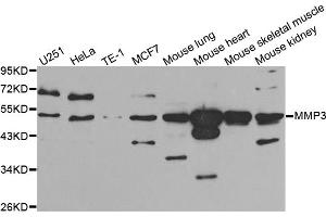 Western blot analysis of extracts of various cell lines, using MMP3 antibody (ABIN5970544) at 1/1000 dilution. (MMP3 antibody)