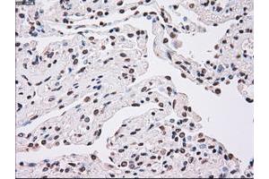 Image no. 1 for anti-Polo-Like Kinase 1 (PLK1) antibody (ABIN1500283) (PLK1 antibody)