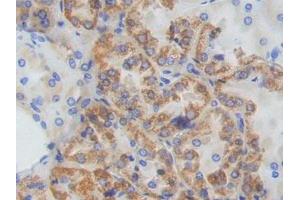 IHC-P analysis of Human Kidney Tissue, with DAB staining. (ADCY9 antibody  (AA 1029-1282))