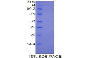 SDS-PAGE analysis of Human Karyopherin alpha 1 Protein. (KPNA1 Protein)