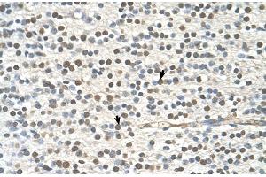 Human Brain (GAPVD1 antibody  (N-Term))