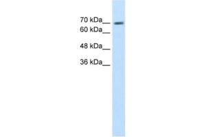 Western Blotting (WB) image for anti-EPS8-Like 1 (EPS8L1) antibody (ABIN2462593) (EPS8-Like 1 antibody)