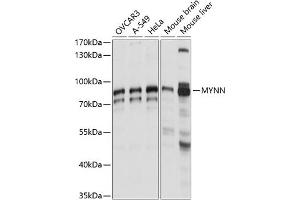 Western blot analysis of extracts of various cell lines, using MYNN antibody (ABIN7268741) at 1:1000 dilution. (Myoneurin antibody  (AA 1-300))