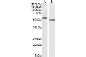 Western Blotting (WB) image for anti-Solute Carrier Family 18 (Vesicular Monoamine Transporter), Member 2 (SLC18A2) (C-Term) antibody (ABIN570915)