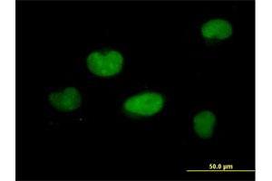 Immunofluorescence of purified MaxPab antibody to ZNF449 on HeLa cell.