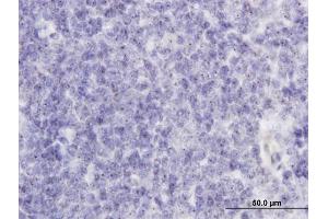 Immunoperoxidase of monoclonal antibody to RAB36 on formalin-fixed paraffin-embedded human tonsil.