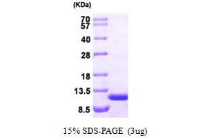 SDS-PAGE (SDS) image for alpha Hemoglobin Stabilizing Protein (aHSP) (AA 1-102) protein (ABIN666787) (aHSP Protein (AA 1-102))