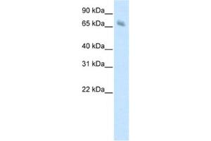 Western Blotting (WB) image for anti-Kelch-like protein 41 (KLHL41) antibody (ABIN2461775) (Kelch-like protein 41 (KLHL41) antibody)