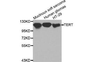 Western blot analysis of extracts of various cell lines, using TERT antibody. (TERT antibody  (C-Term))