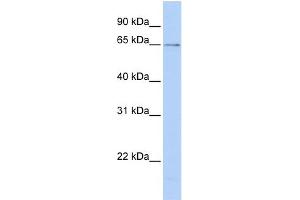 WB Suggested Anti-PPIL2 Antibody Titration: 0. (PPIL2 antibody  (C-Term))