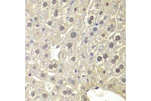 Immunohistochemistry of paraffin-embedded mouse liver using NR3C1 antibody. (Glucocorticoid Receptor antibody)